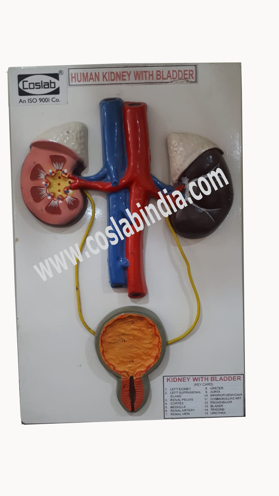 Kidney - H-17 / 14017 , H-17 / 14018 , H-17 / 140120 , H-17 / 140122